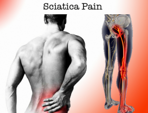 sciatica-low-back